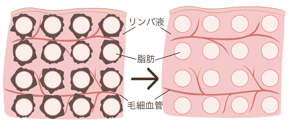 脂肪