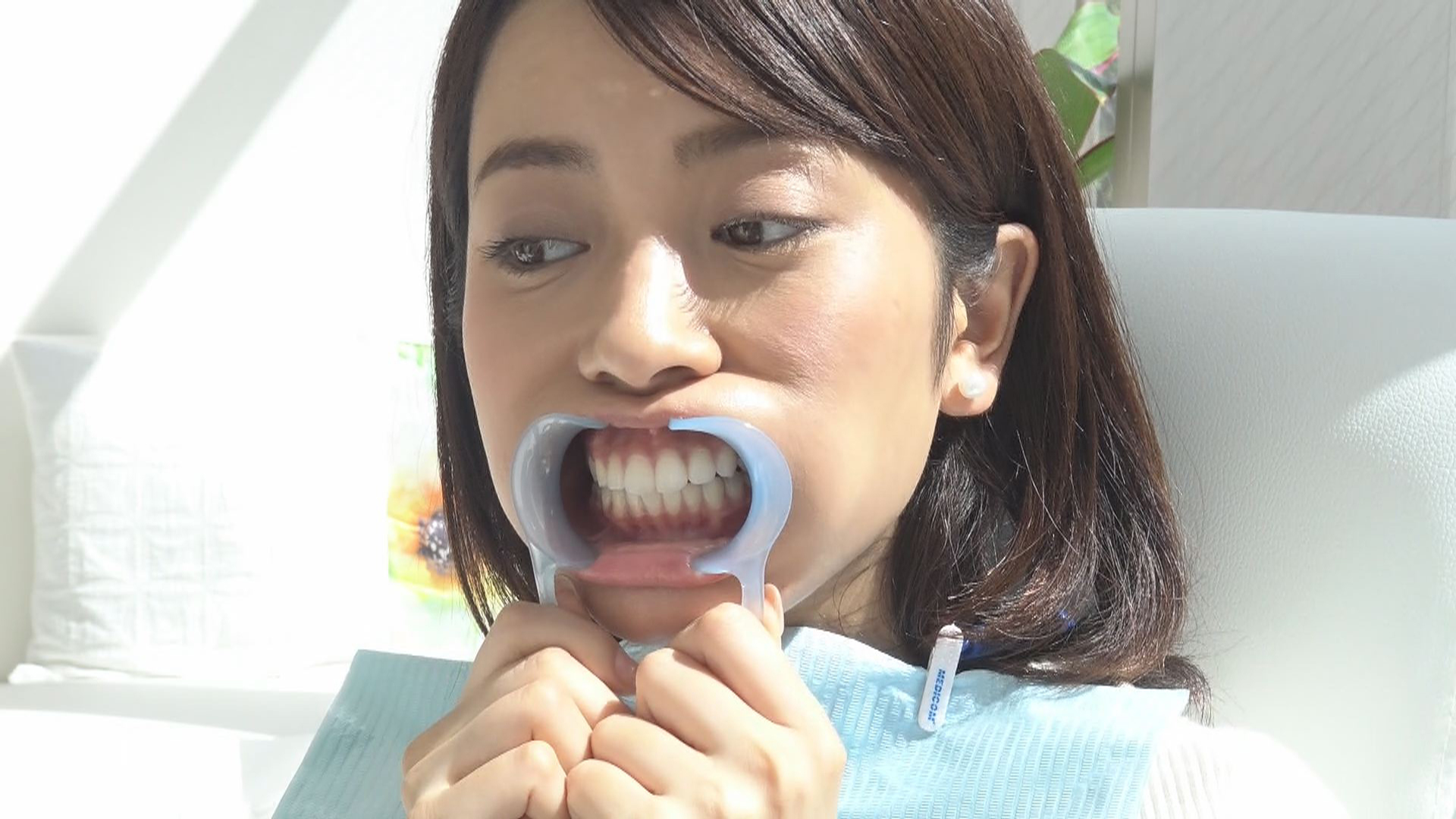 セルフホワイトニング4